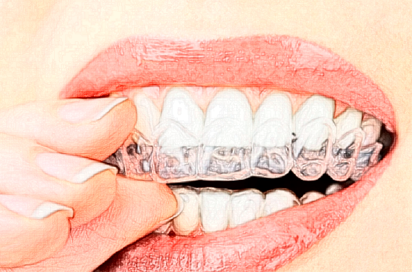 淮北頜面正畸價格表?頜面正畸哪個醫(yī)院好