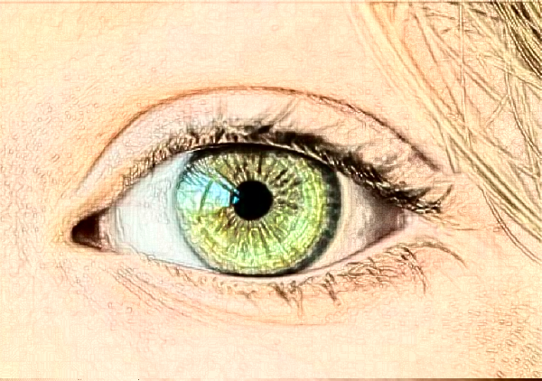 杭州佳麗不開(kāi)刀去眼袋需要多少錢?不開(kāi)刀去眼袋能保持多久?