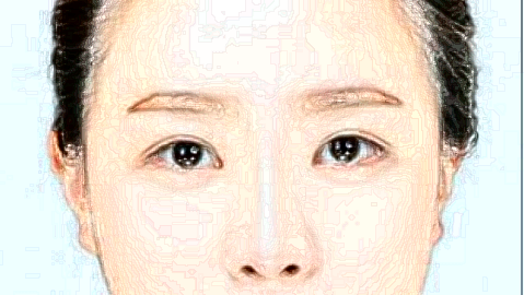 祛斑小妙招(9月更新)_2024祛斑收費價目表