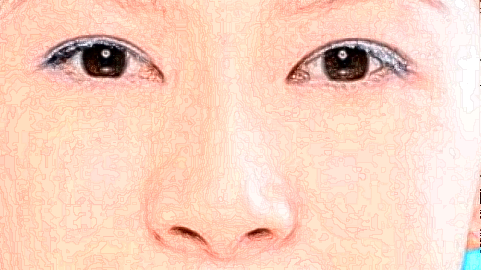 去淚溝價格表(2024年9月?lián)屜?_怎么消除淚溝