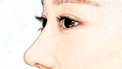 墊鼻失敗修復(fù)的價格表_墊鼻失敗修復(fù)步驟