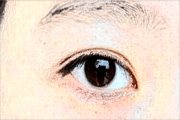 保定華美去眼袋價(jià)目表(價(jià)格表)怎么樣