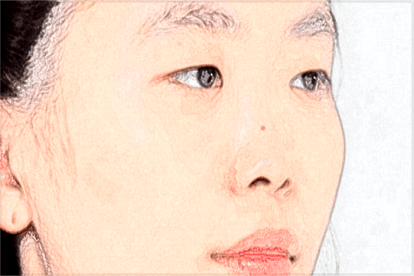 2024北京美萊熱瑪吉價格表_北京美萊熱瑪吉好嗎