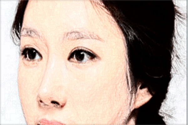 2024北京美萊醫(yī)院怎么樣?北京美萊祛斑價目表