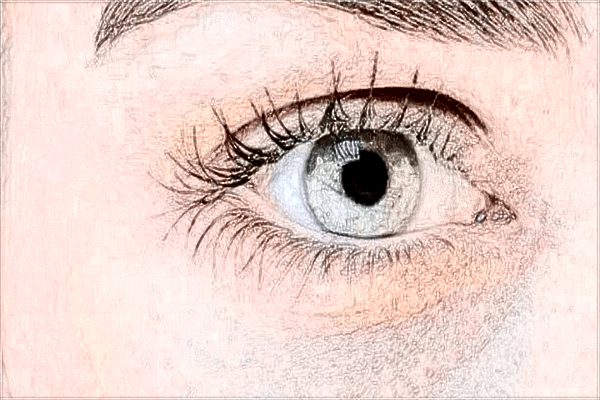 2024開眼角手術(shù)價(jià)格表(10月更新)_開眼角會(huì)留疤嗎