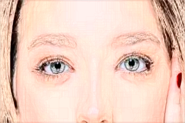 2024割雙眼皮價(jià)目表_深圳嘉美怎么樣