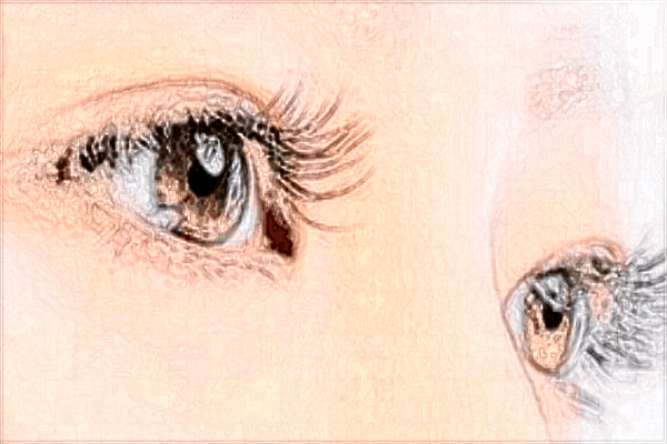 鄭州天后做雙眼皮怎么樣_2024做雙眼皮價格表