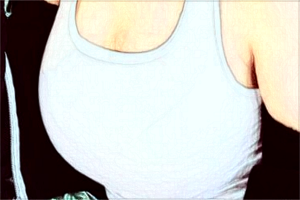 深圳嘉美假體隆胸怎么樣_2024假體隆胸價(jià)目表