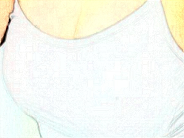 常州玻尿酸隆胸醫(yī)院排名_(十月公布)玻尿酸隆胸價目表