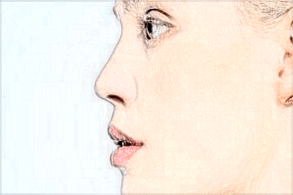 2024常州吸脂瘦臉價目表(價格表)哪家醫(yī)院好