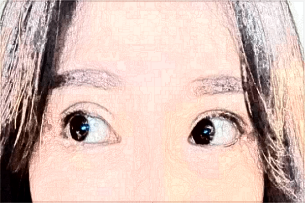 2024?？陔p眼皮醫(yī)院排名_【醫(yī)生推薦】