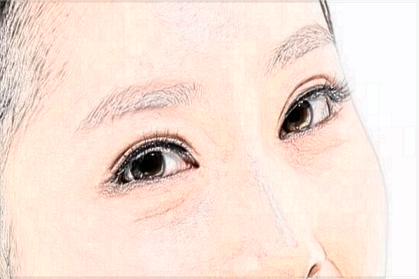 2024?？陔p眼皮醫(yī)院排名_【醫(yī)生推薦】