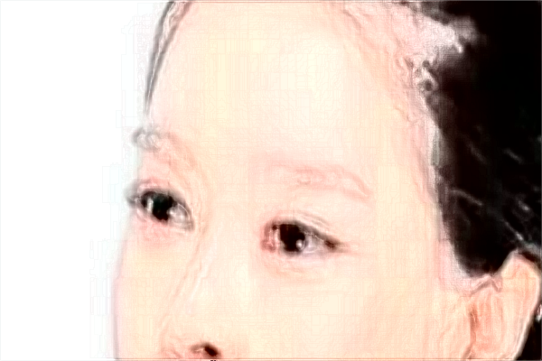 2024割雙眼皮價(jià)目表公布_割雙眼皮大概多久能恢復(fù)正常