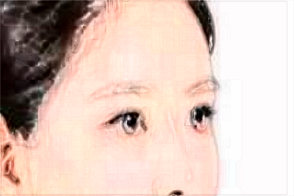 2024埋線雙眼皮價目表公布_埋線雙眼皮的危害性