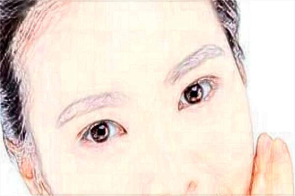 2024埋線雙眼皮價目表公布_埋線雙眼皮的危害性