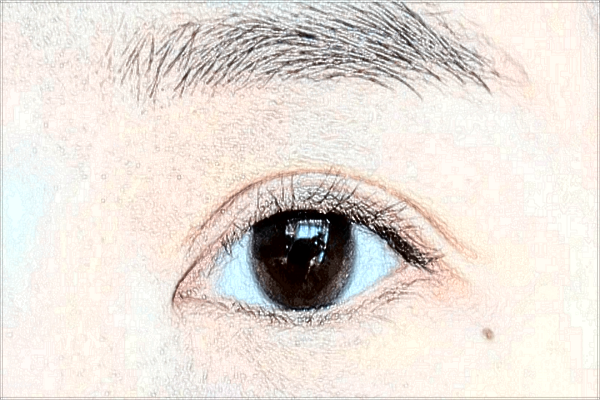 2024開眼角價目表公布_開眼角有疤痕增生怎么辦