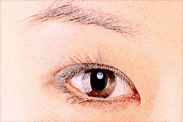 2024開眼角價目表公布_開眼角有疤痕增生怎么辦