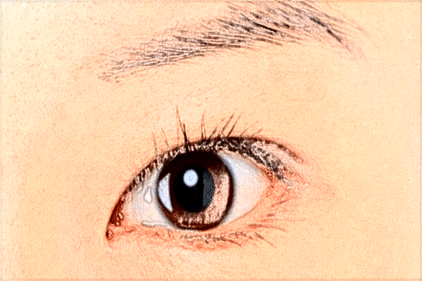 2024開眼角價目表公布_開眼角有疤痕增生怎么辦