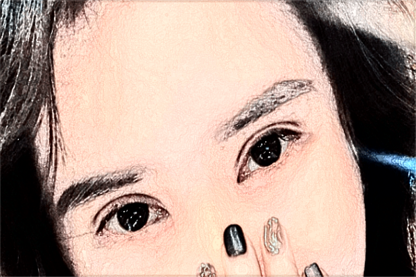 割雙眼皮要多長時(shí)間完成?割雙眼皮要拆線嗎?