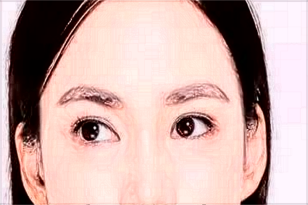 割雙眼皮需要多少錢一次?割雙眼皮需要恢復多長時間?