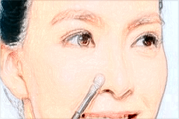 耳垂矯正價(jià)格表_垂耳矯正后還會垂下來嗎