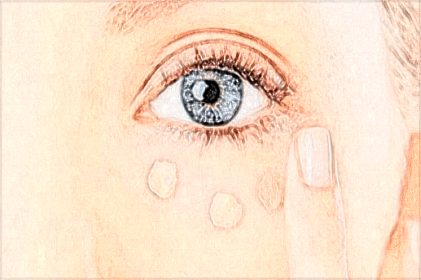 2024上海華美醫(yī)院割三點(diǎn)雙眼皮價(jià)格表