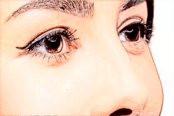 割雙眼皮有哪些危害性?割雙眼皮有什么危害或者后遺癥？