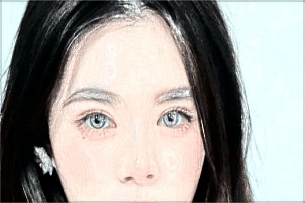 割雙眼皮會(huì)留疤痕不?割雙眼皮會(huì)導(dǎo)致視力下降嗎?