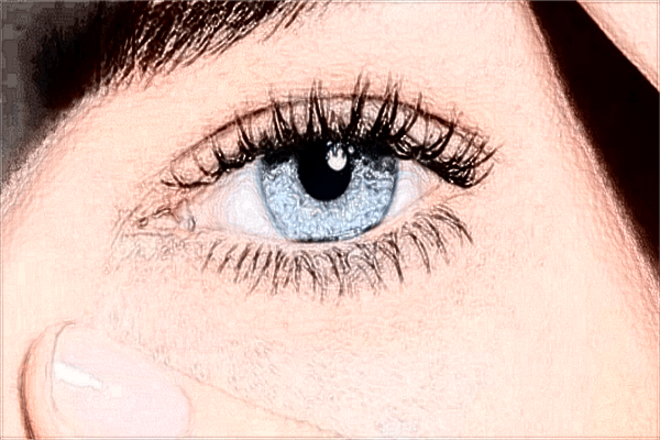 重慶市切開雙眼皮價格表_2024切開雙眼皮價格公示