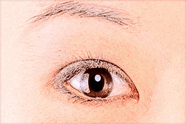 2024北京同仁醫(yī)院割雙眼皮價(jià)格表_割雙眼皮有沒(méi)有風(fēng)險(xiǎn)