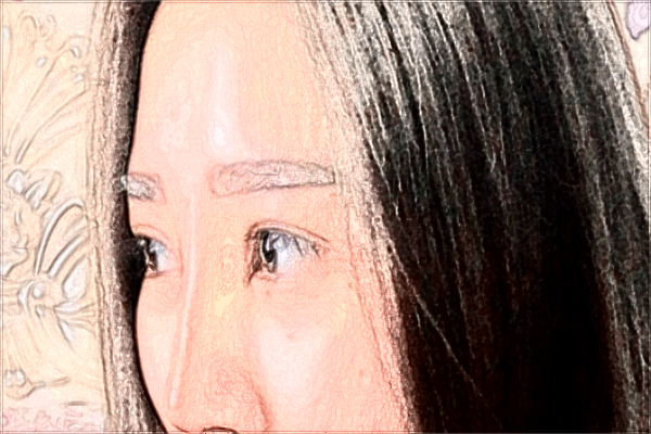 2024義烏眼周年輕化價目表_哪家醫(yī)院好