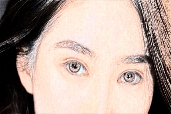 義烏去眉間紋醫(yī)院推薦_哪位醫(yī)生好