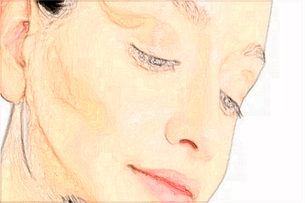 2024義烏鷹鉤鼻矯正價(jià)格表(價(jià)目表)怎么樣