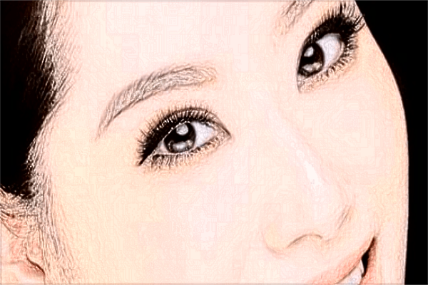 重慶聯(lián)合麗格做雙眼皮價目表【雙眼皮案例】