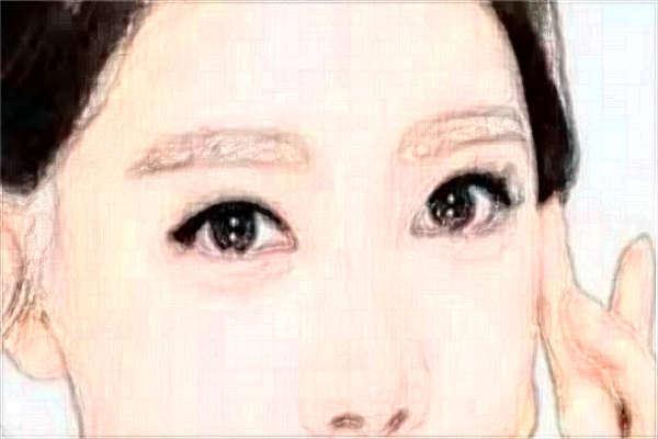 2024煙臺洛神做眼袋哪位醫(yī)生技術好_【附眼袋案例】