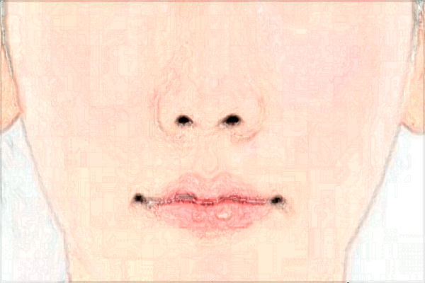 2024濟(jì)南隆鼻整形醫(yī)院排行榜_附醫(yī)生名單