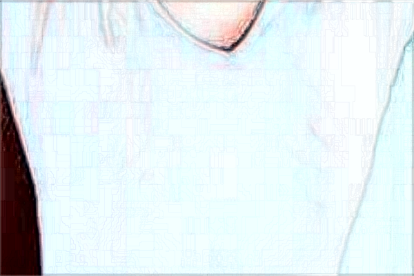 2024重慶聯(lián)合麗格徐鐸技術怎么樣【附手術案例】