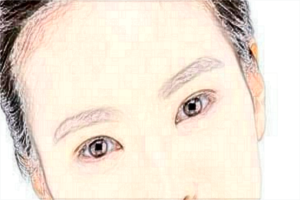 2024北京沃爾整形醫(yī)院雙眼皮價目表(價格表)怎么樣