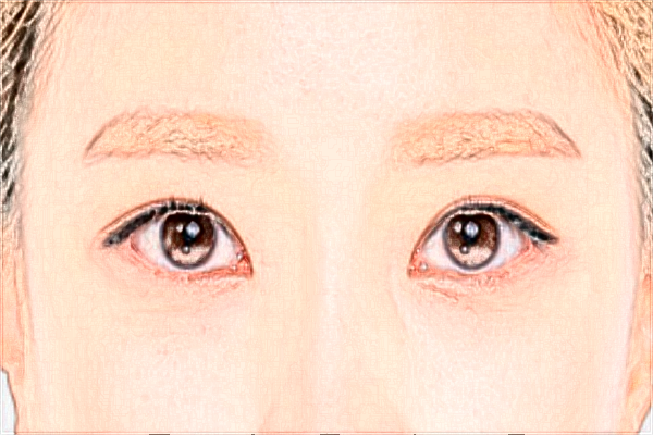 上海時光整形醫(yī)院做提眉怎么樣_提眉術(shù)和全切雙眼皮哪個效果好