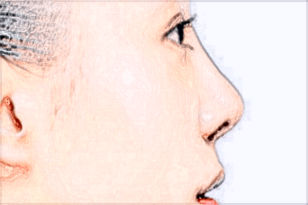 四川米蘭柏羽熱瑪吉貴嗎?熱瑪吉收費(fèi)價(jià)目表