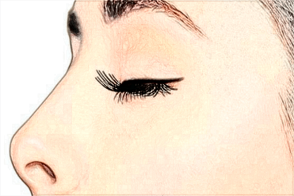 2024酒槽鼻價格表_酒槽鼻需要多長時間