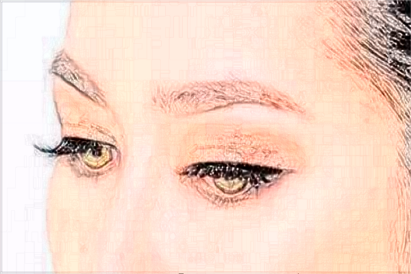 2024北京協(xié)和醫(yī)院做雙眼皮大概多少錢(qián)_附醫(yī)生名單