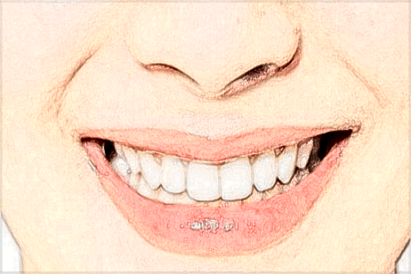 種植牙多少錢一顆_種植牙價(jià)格一覽表