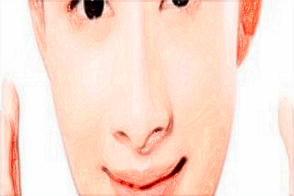 2024北京協(xié)和醫(yī)院隆鼻大概多少錢(qián)_附醫(yī)生名單