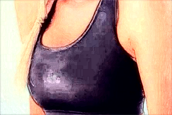 上海伊萊美哪個醫(yī)生隆胸好_附隆胸手術(shù)案例