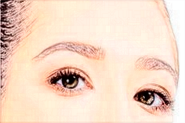 上海伊萊美做雙眼皮怎么樣_醫(yī)生推薦