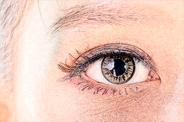 2024上海伊萊美去眼袋做的好嗎【附去眼袋案例】