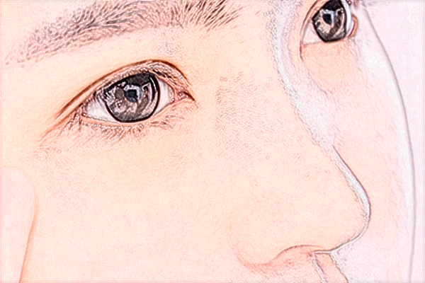 2024上海伊萊美去眼袋做的好嗎【附去眼袋案例】