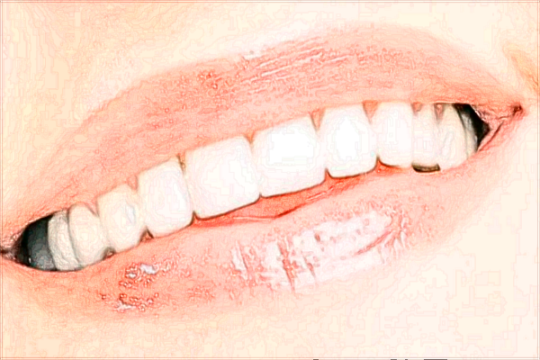 2024北京中醫(yī)醫(yī)院補(bǔ)牙多少錢_哪位醫(yī)生技術(shù)比較好