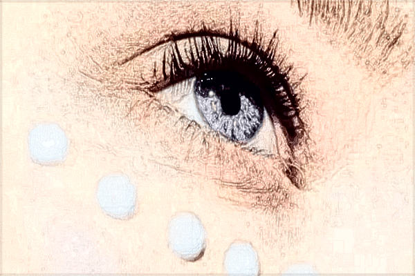 鄭大一附院割雙眼皮怎么樣?割雙眼皮案例